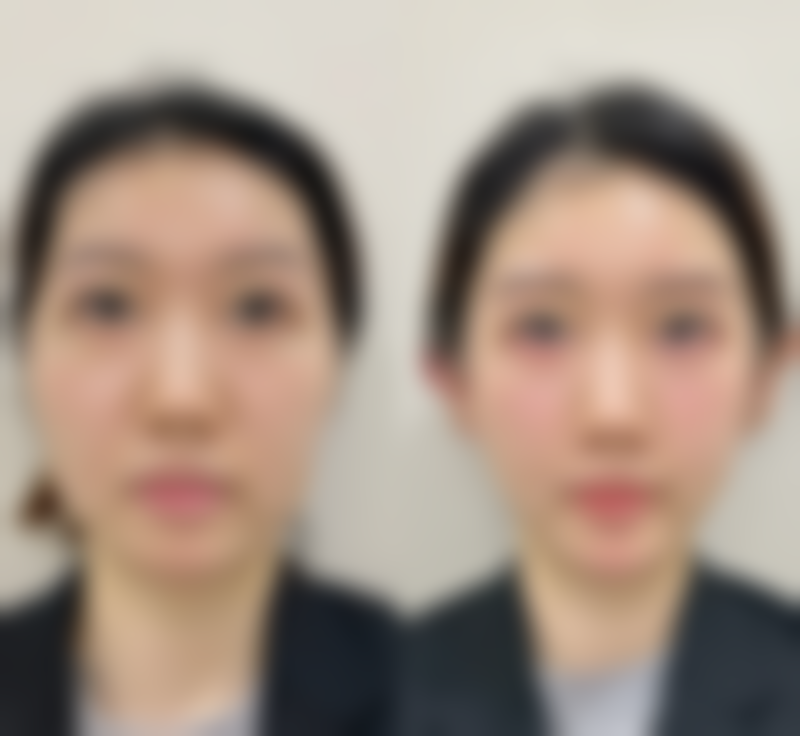 长沙科颜美医疗美容怎么预约