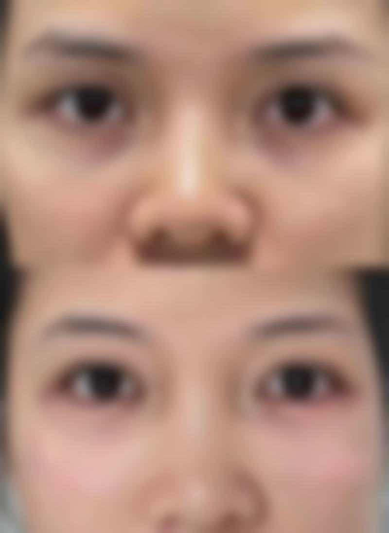 湖南永州倾城医疗美容口碑评价怎么样?