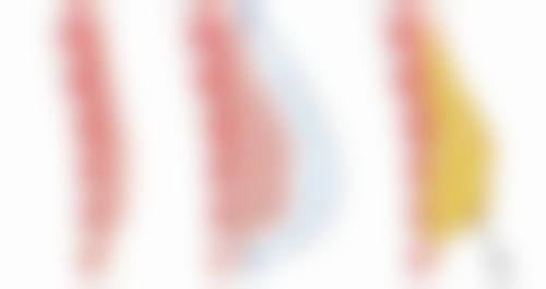 青岛熙朵植发医疗美容诊所正规吗?