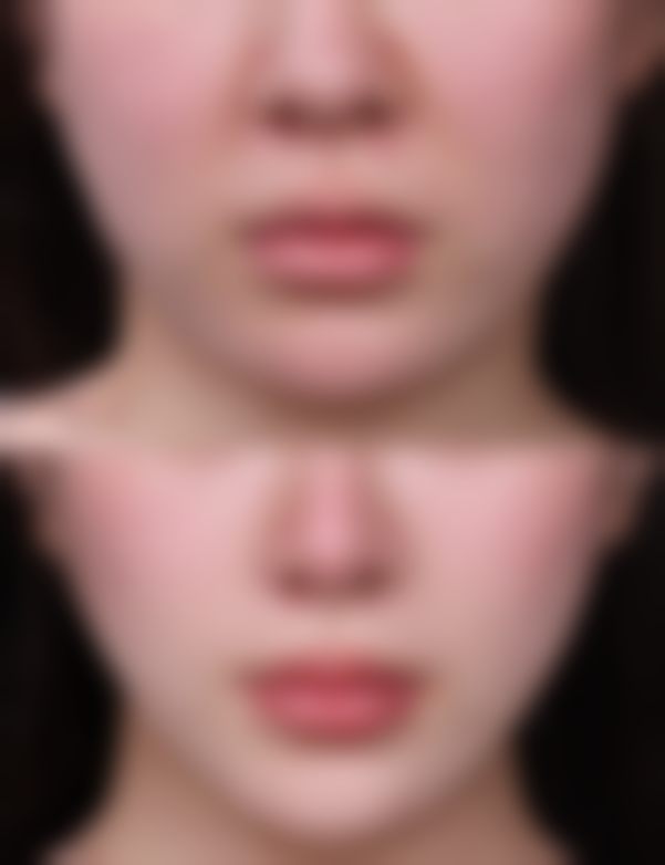 费用影响因素有哪些