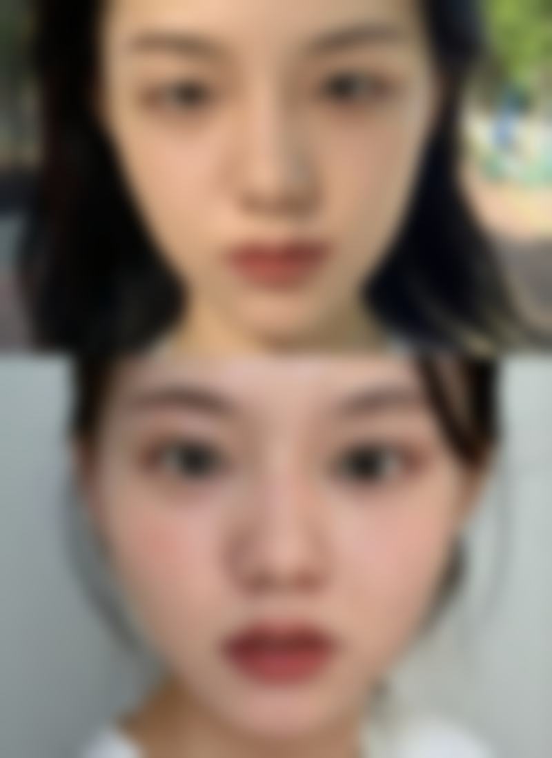 青岛熙朵植发医疗美容诊所怎么预约