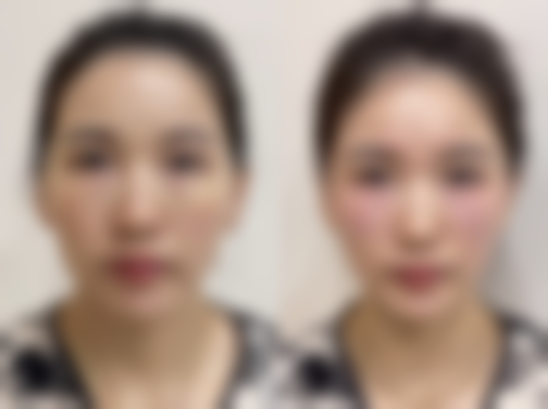 乳山奥美涵熙整形医院口碑评价怎么样？