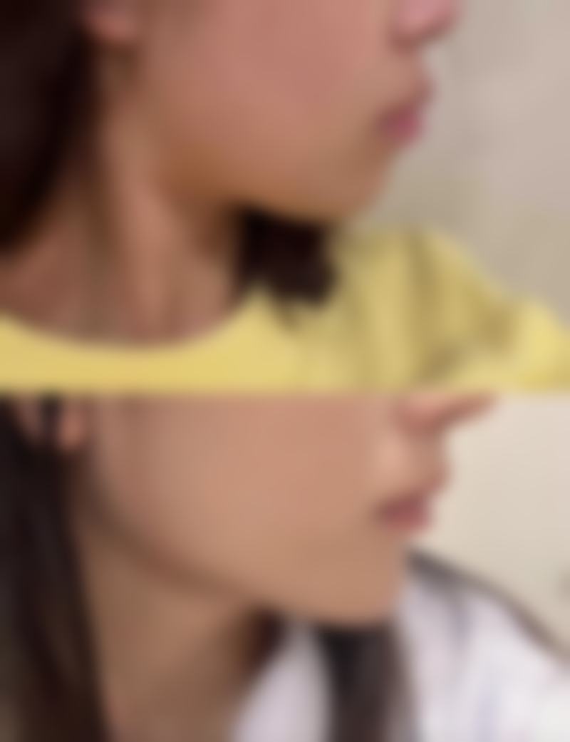 武汉博爱医院整形美容中 心正规吗?