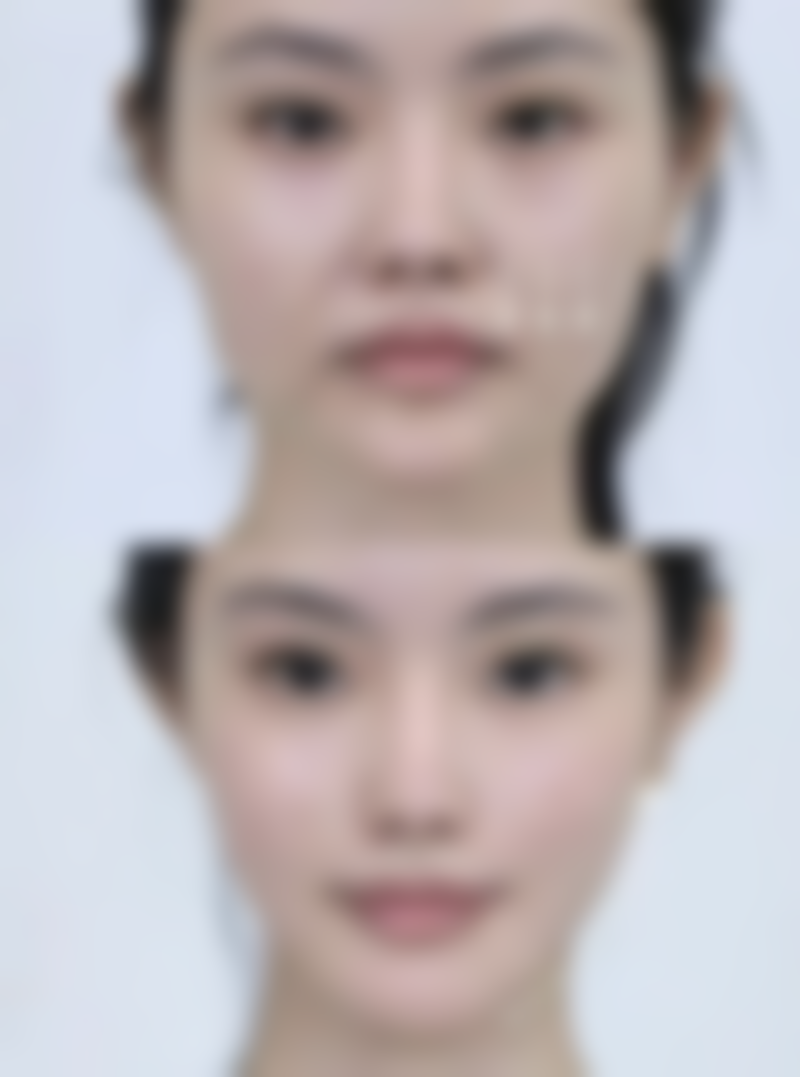 关于费用的常见问题解答