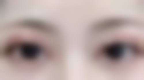 徐州易慧美医疗美容门诊部口碑评价怎么样？