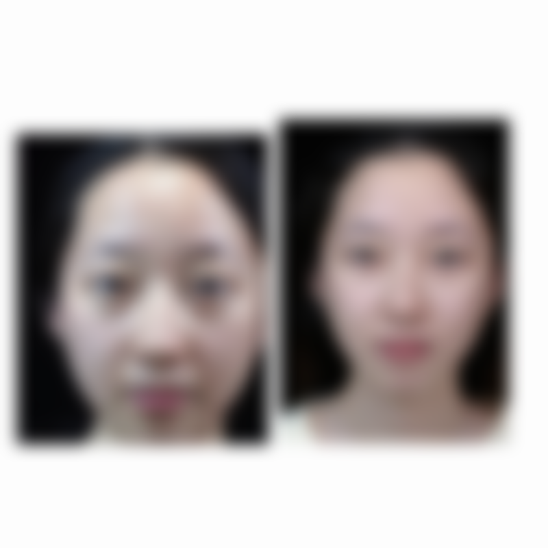 荆州蓝鸟整形医疗美容口碑评价怎么样？