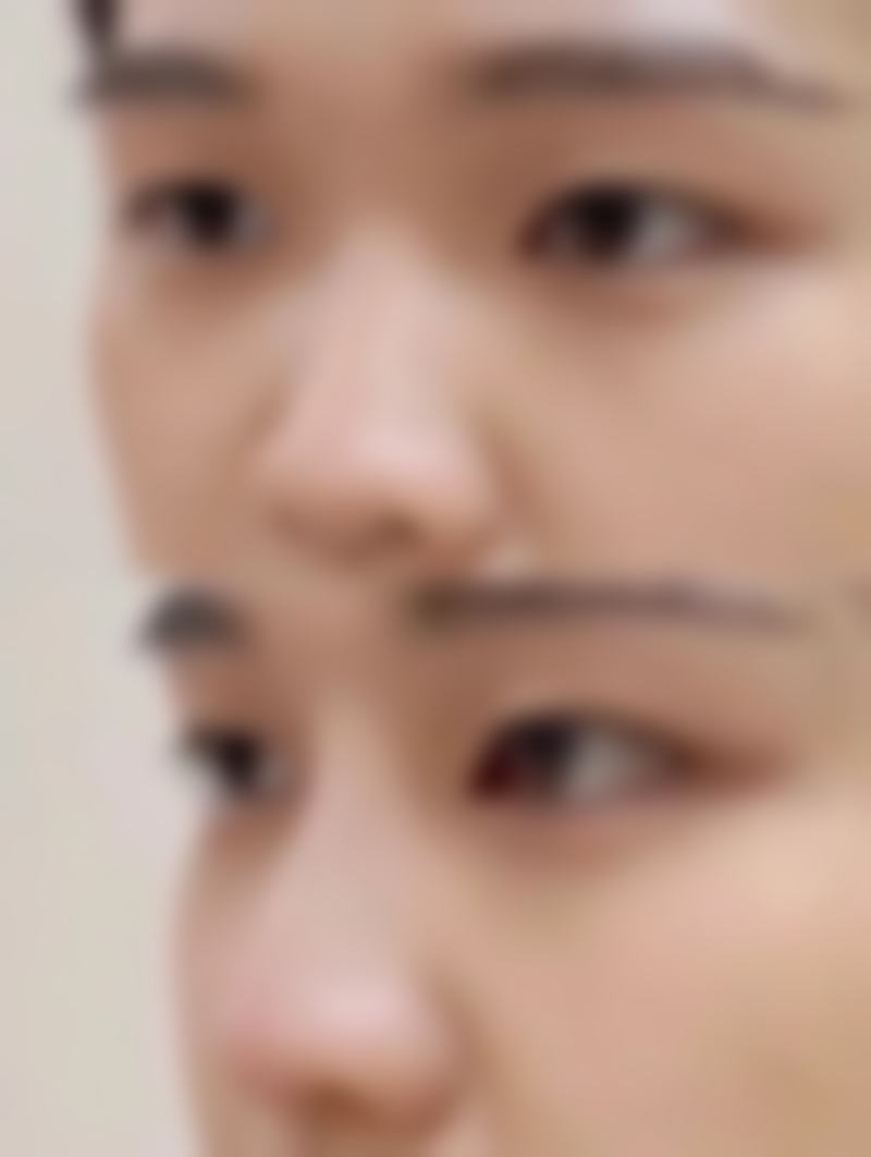 徐州易慧美医疗美容门诊部怎么预约