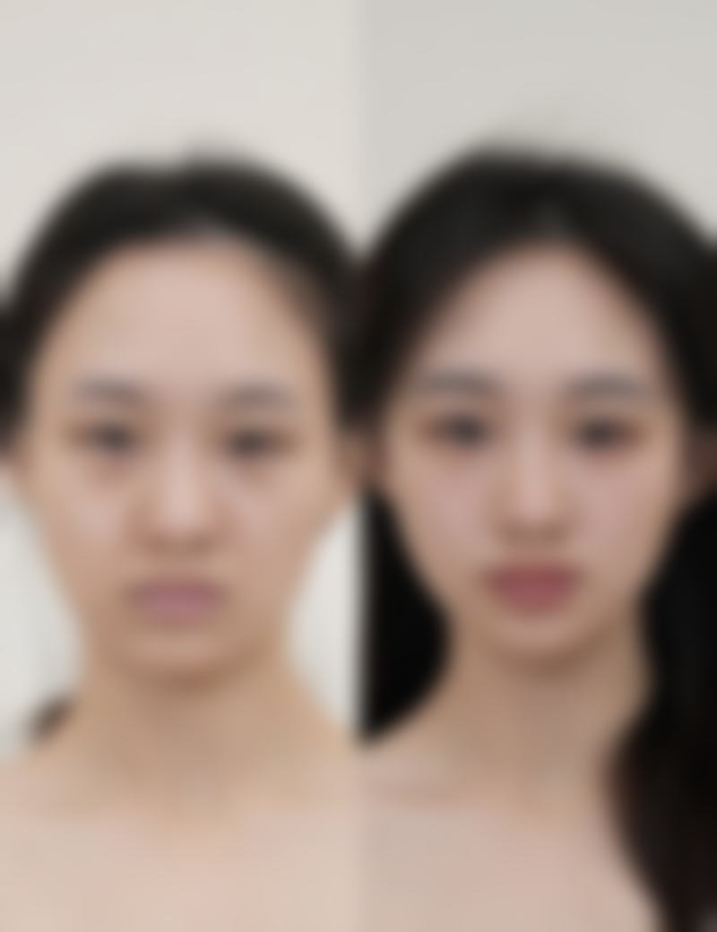 东莞韩秀医疗美容门诊部口碑评价怎么样？