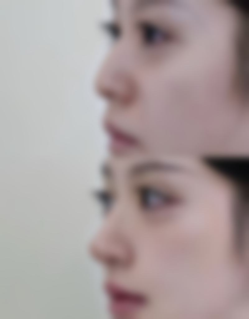 北京韩誉国都整形医疗美容医院口碑评价怎么样？