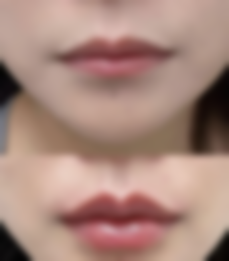 西安富隆光知美医疗美容诊所口碑评价怎么样?