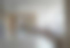 35岁的我在北京黄寺医疗美容门诊部做完拉皮手术+钻石精雕，术后7天效果显著！ 