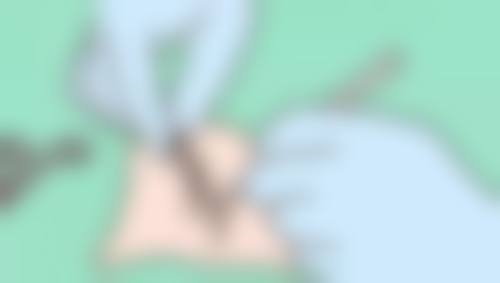 烟台曹博士美容整形医院口碑评价怎么样?