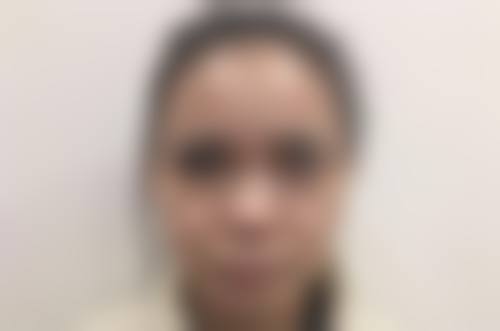 三门峡张琳医疗美容诊所口碑评价怎么样？