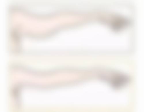 北京斯凯丽雅医疗美容诊所蔡铭华医生微整形技术怎么样？