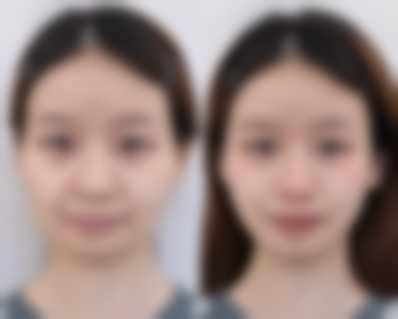 北京如颜惠芳医疗美容诊所口碑评价怎么样？