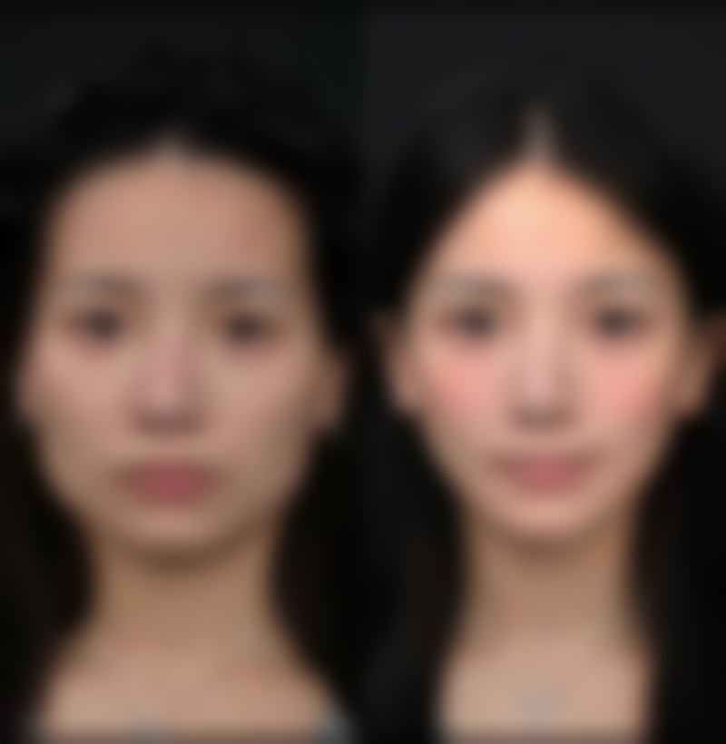 成都美斯迪医疗美容诊所口碑评价怎么样？