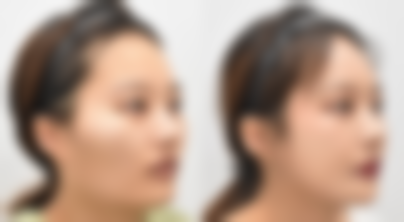 柳州丽人医院正规吗？