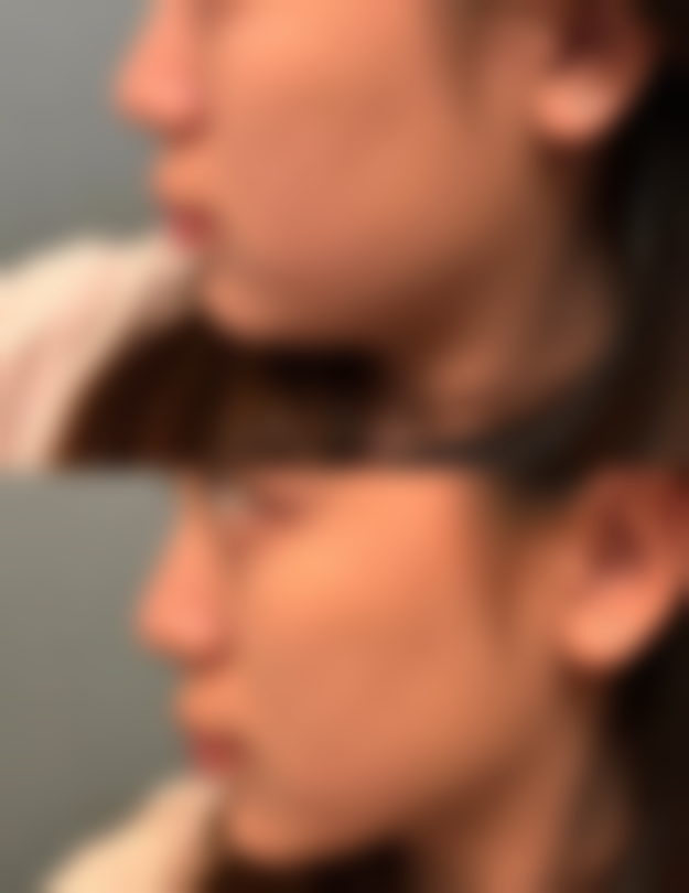 桂林美丽焦点医疗美容门诊部正规吗？