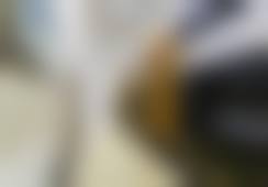 威海正源整形美容医院荆煜林医生激光脱毛技术怎么样？