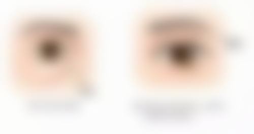 景德镇亚菲整形医疗美容门诊部正规吗？