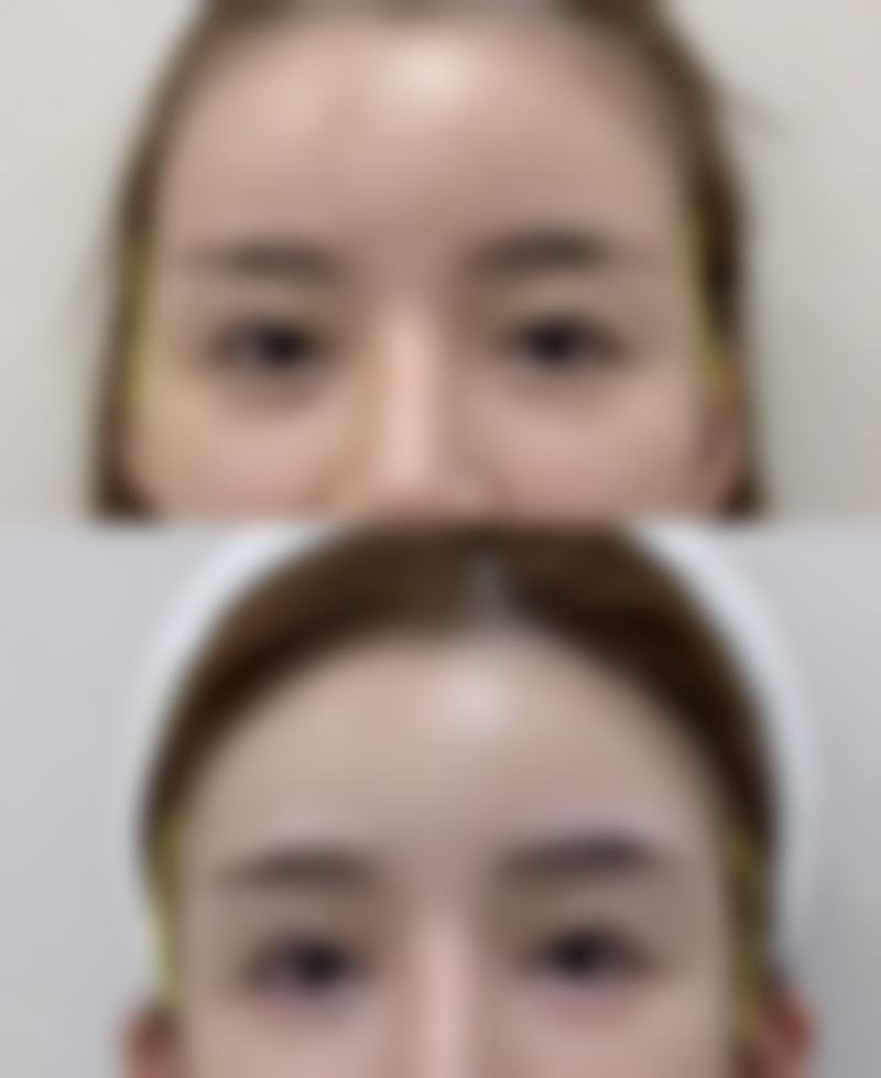 呼和浩特市亚太医疗美容医院口碑评价怎么样？