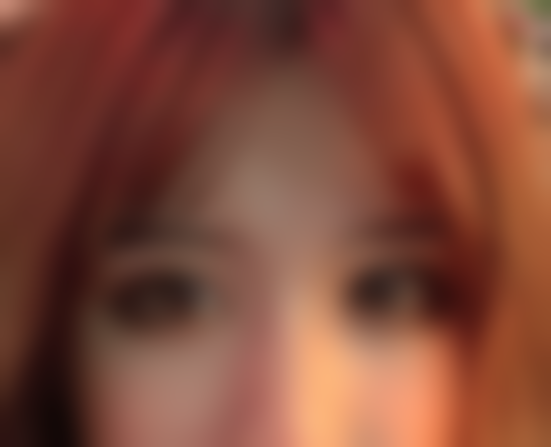 重庆松山医院医学美容科双眼皮手术体验：医生专业靠谱，术后双眼对称变大超开心！ 