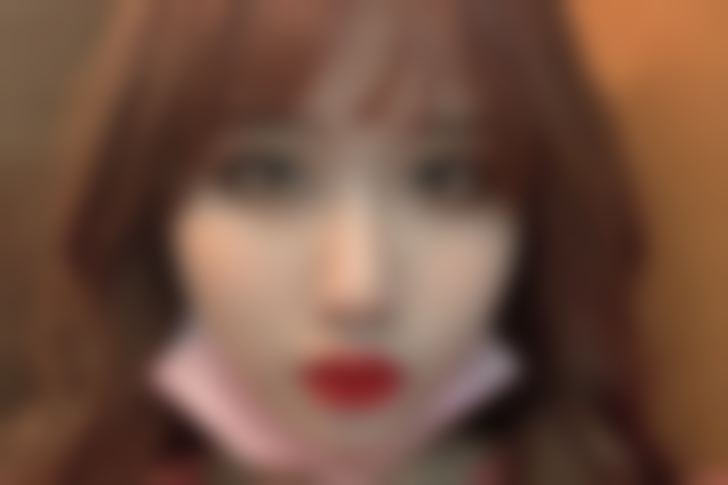 重庆松山医院医学美容科双眼皮手术体验：面诊过程专精又贴心，怎能不开心？