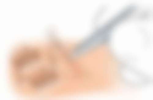 福州碧莲盛植发医院医生介绍