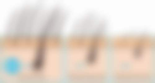 福州碧莲盛植发医院