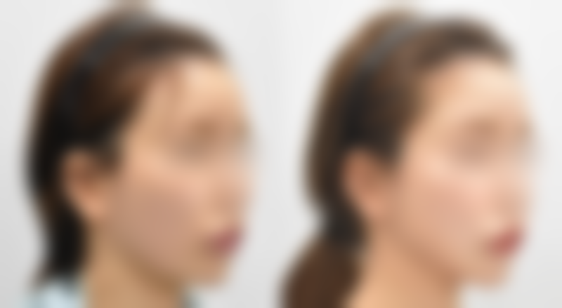 成都锦江派瑞思医疗美容诊所怎么预约