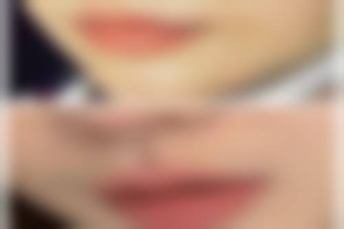 上海美之星医疗美容医院口碑评价怎么样？