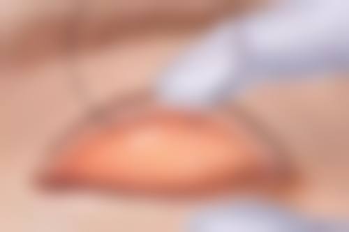 威海芊禾整形医院正规吗？