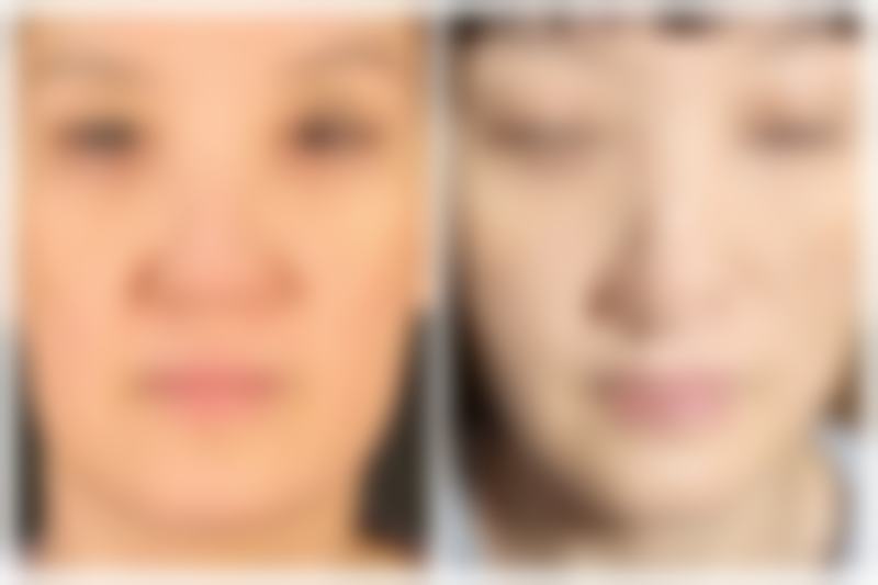 沈阳汇禾医疗美容门诊部口碑评价怎么样？