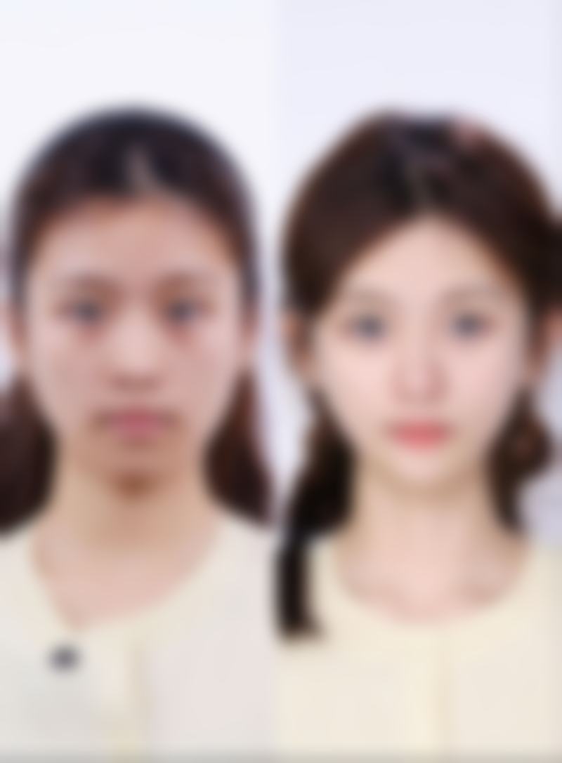 许昌博爱医院医疗美容科张保军 医生患者评价