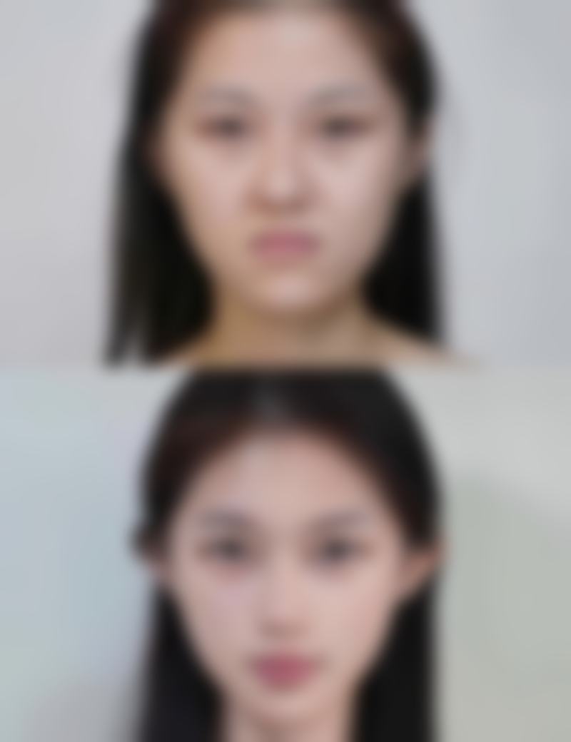 海口美兰整形美容医院口碑评价怎么样？