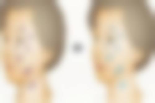 韩国ohkims整形外科医院口碑评价怎么样？