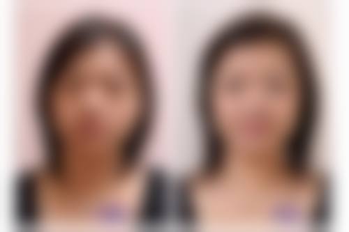 深圳也婷医疗美容诊所口碑评价怎么样？