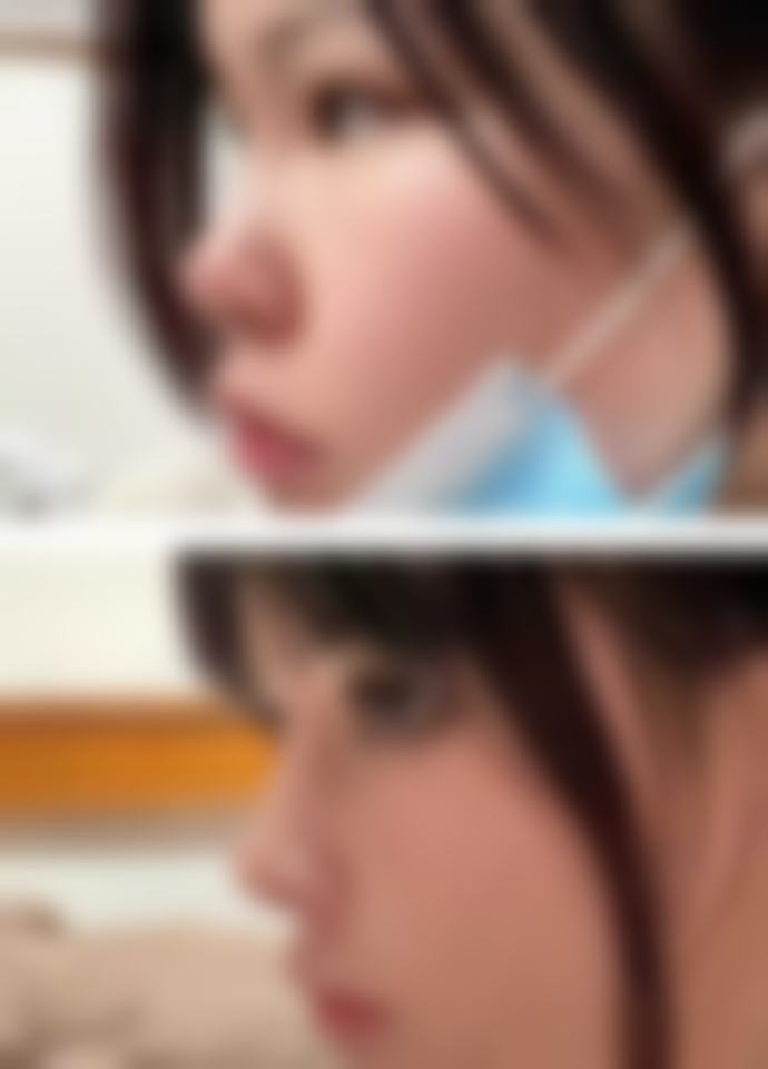 柳州妍美医疗美容诊所彭国凯医生收费价格