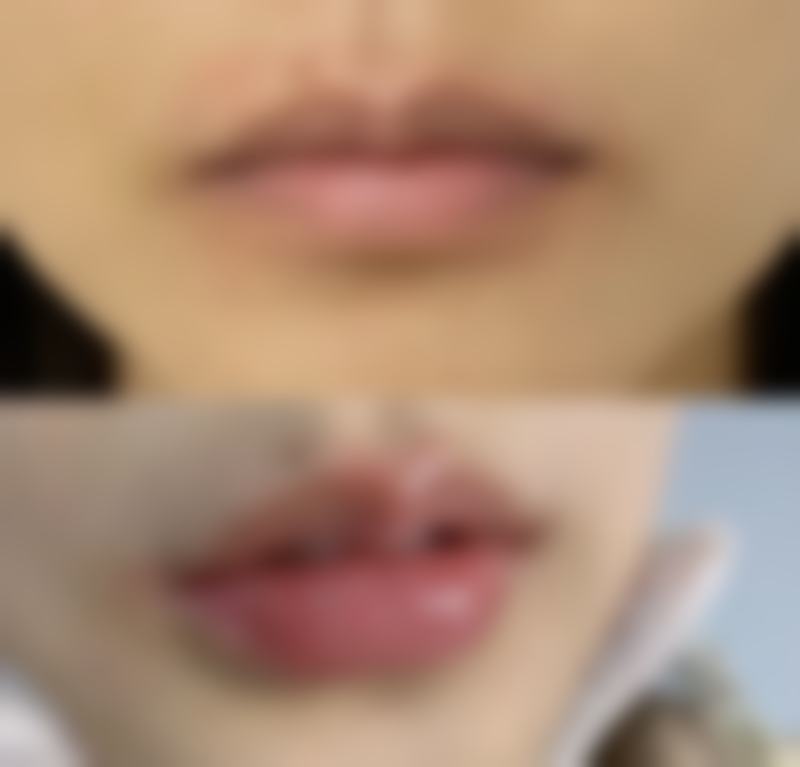 郴州青源医疗美容医院曹腾医生患者评价