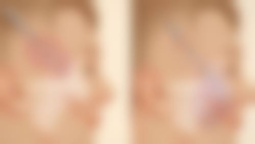 保定杏林整形医院杨桃玉医生患者评价