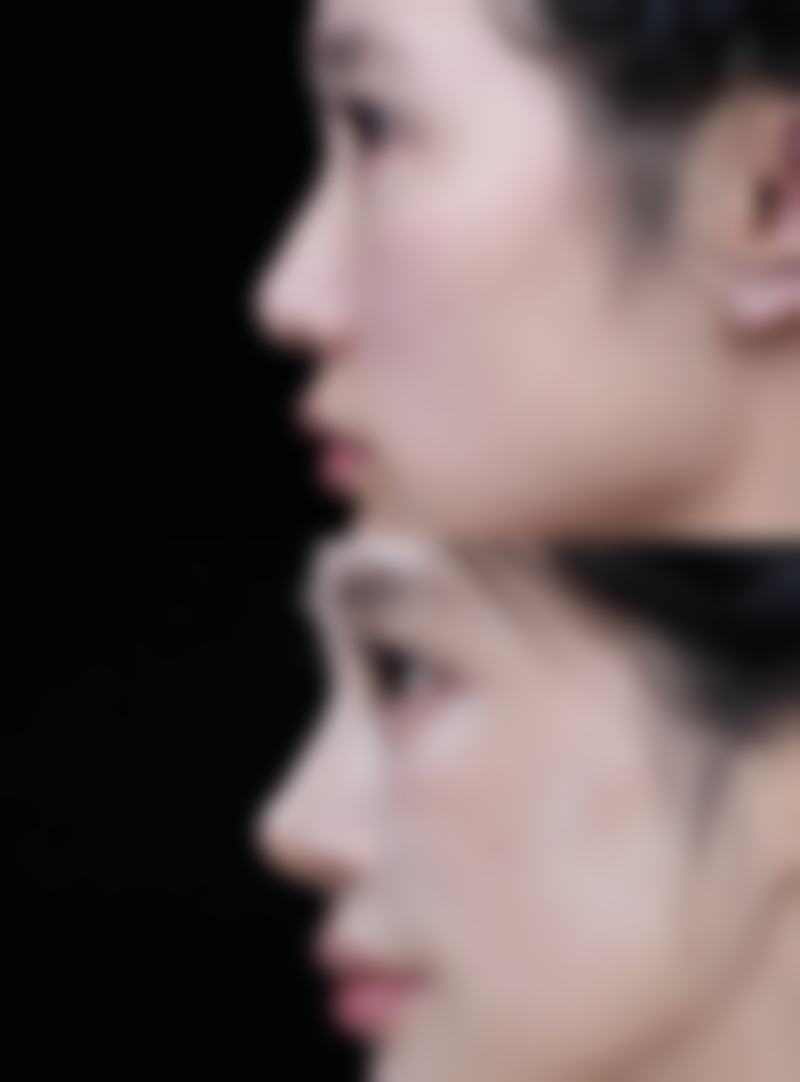 海口雍禾植发美容整形外科诊所收费价格表