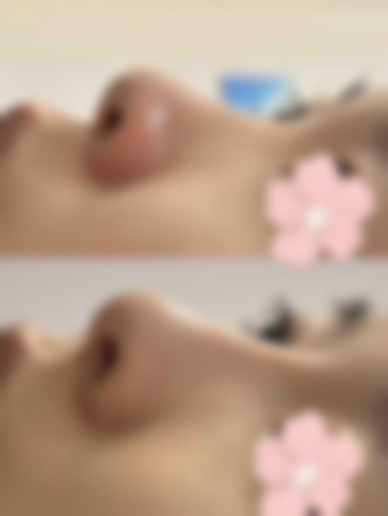 白银市第一人民医院烧伤与整形美容外科正规吗？