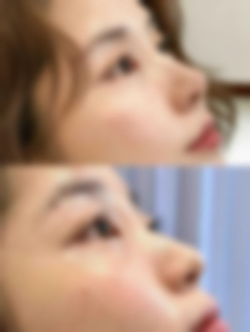 西安玫滋快美医疗美容诊所收费价格表