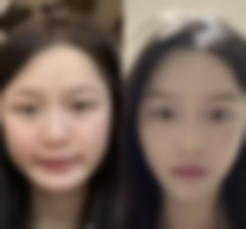 白银市第一人民医院烧伤与整形美容外科怎么预约