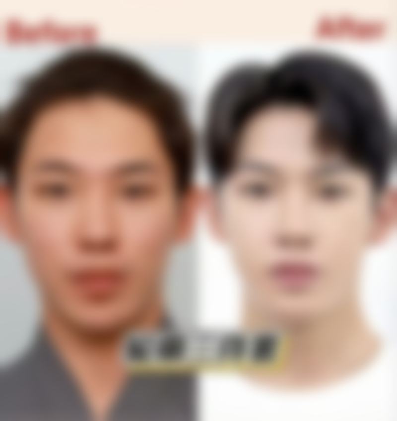 南昌俏佳人医疗美容门诊部刘善医生患者评价