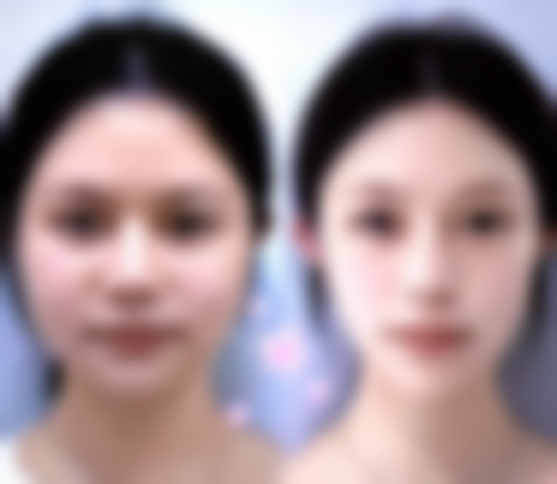 惠州市瑞芙臣整形医疗美容医院口碑评价怎么样？