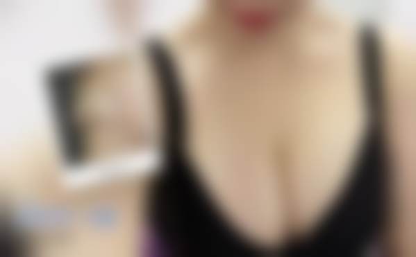 北京禾美嘉医疗美容门诊部全身牛奶酸30ml + 光子嫩肤套餐免费补贴有哪些？