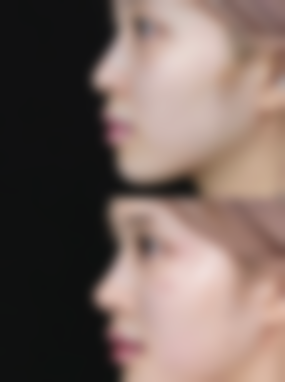 湛江市霞山区美杜莎医疗美容口碑评价怎么样？