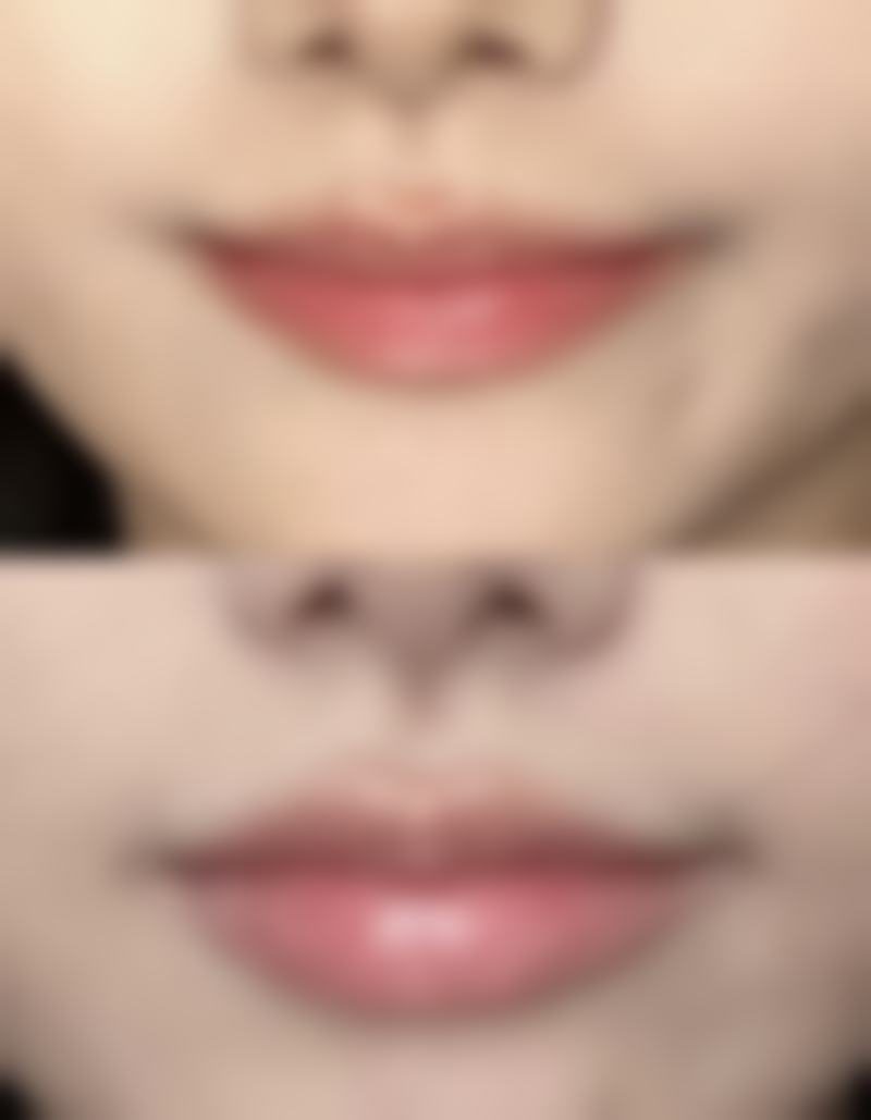 深圳欢乐丽格医疗美容诊所肖晓娟医生预约挂号指南