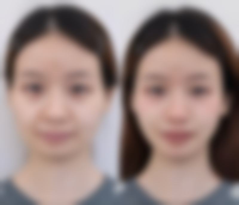 溧阳医疗美容诊所怎么预约